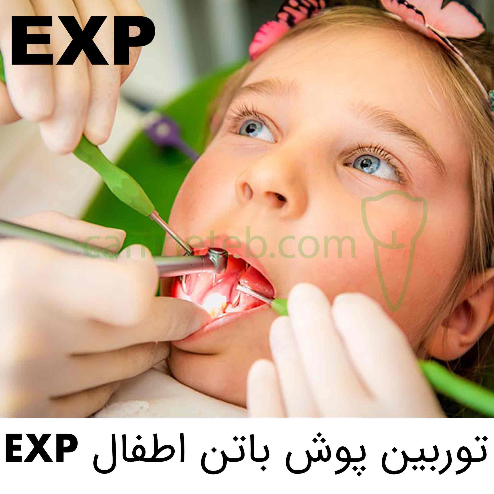 توربین اطفال EXP ای ایکس پی پوش باتن